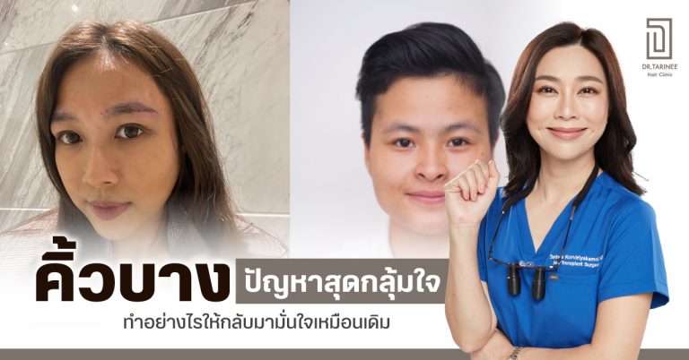 คิ้วบาง ปัญหาสุดกลุ้มใจ ทำอย่างไรให้กลับมามั่นใจเหมือนเดิม