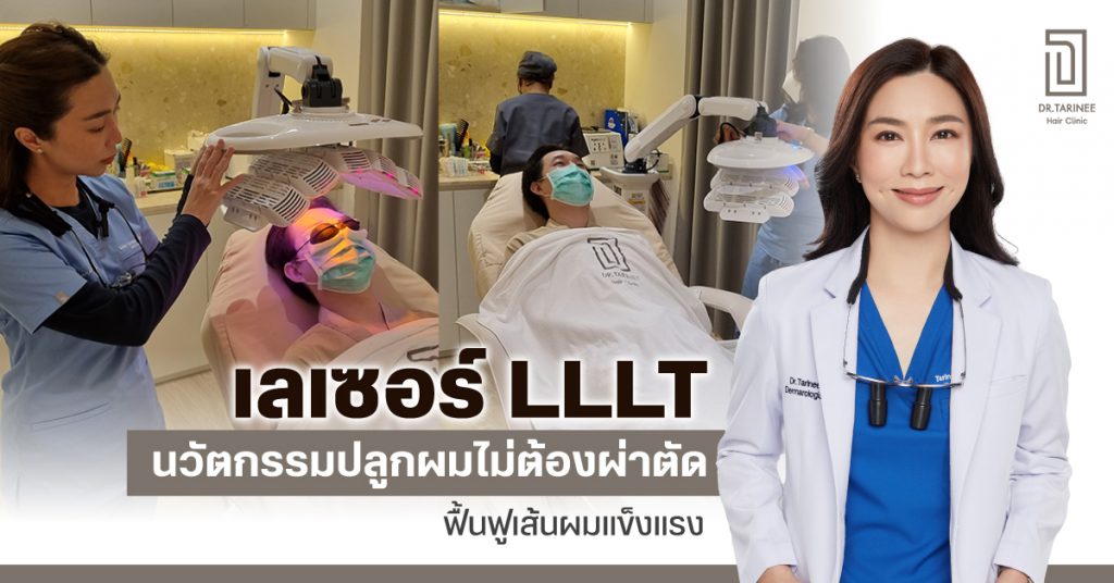 เลเซอร์ lllt