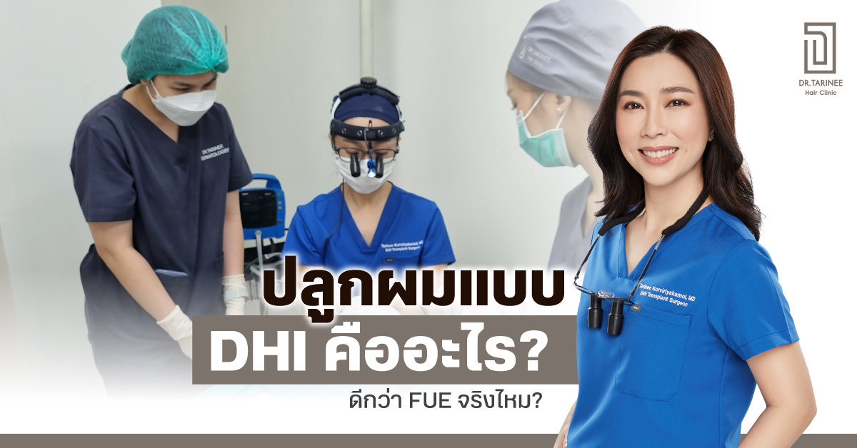 ปลูกผม dhi