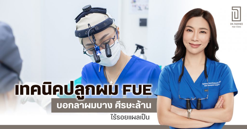 ปลูกผม fue