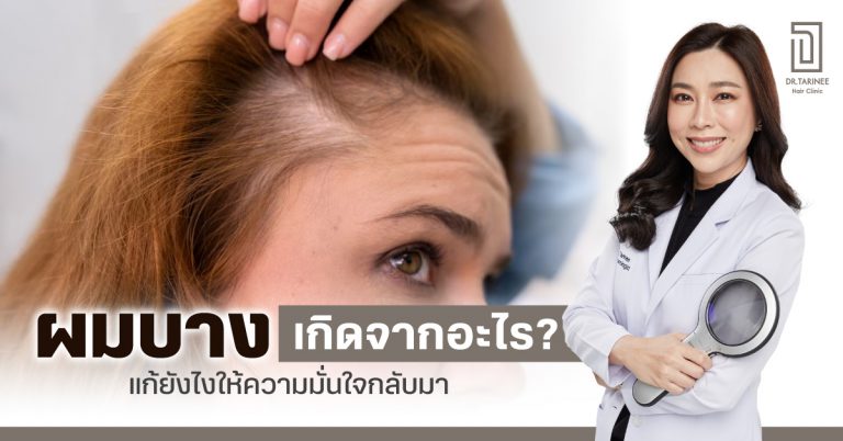 ผมบางเกิดจากอะไร? แก้ยังไงให้ความมั่นใจกลับมา