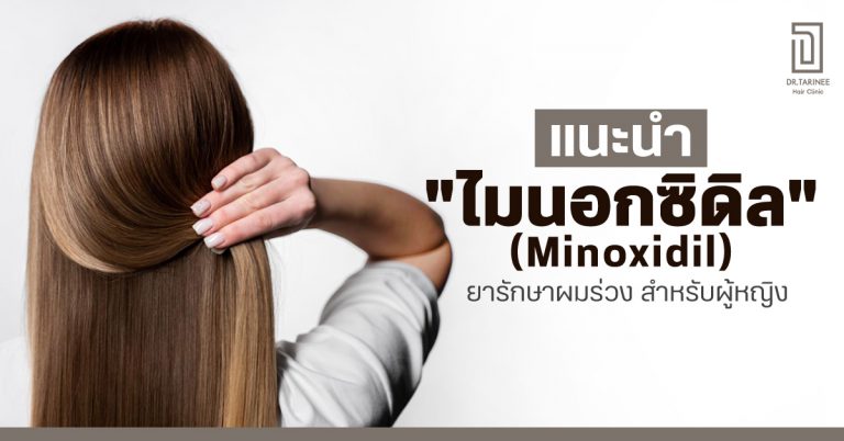 รู้จัก “ไมนอกซิดิล(Minoxidil)”ยารักษาผมร่วง สำหรับผู้หญิง 