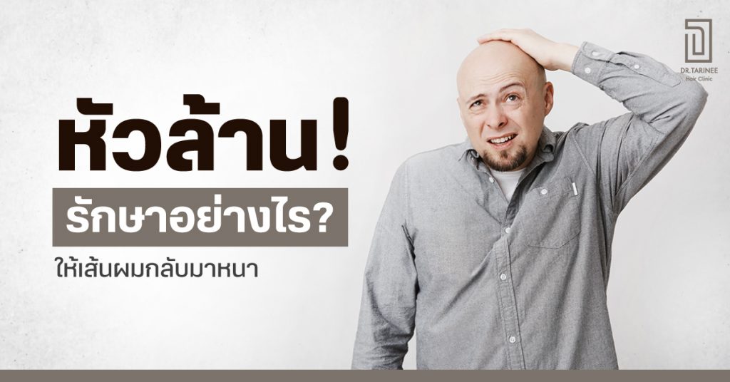 หัวล้าน รักษาอย่างไร