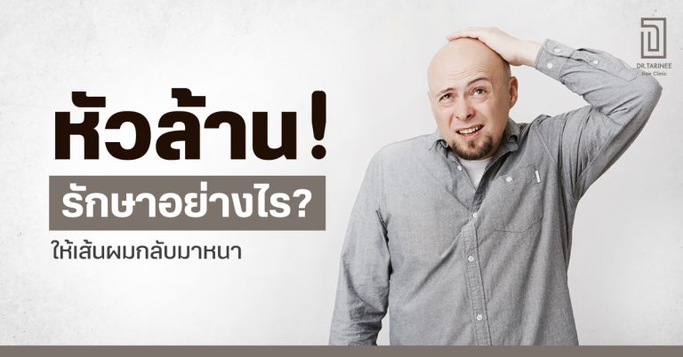 หัวล้าน รักษาอย่างไร? ให้เส้นผมกลับมาหนา