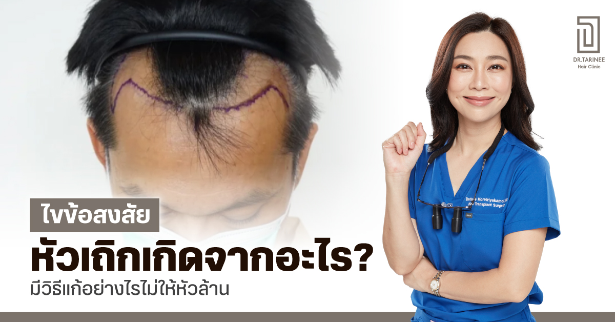 ปัญหาหัวเถิก